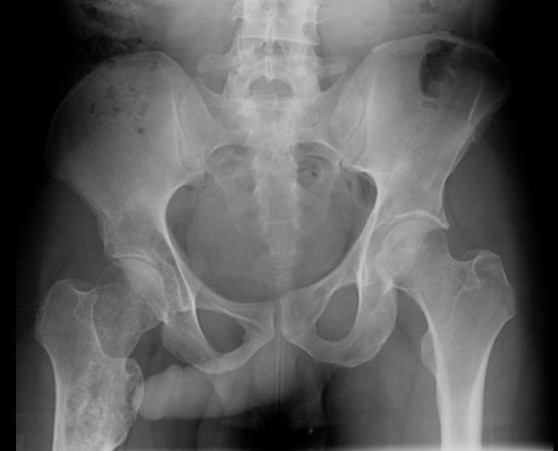 Best of Xray with penis
