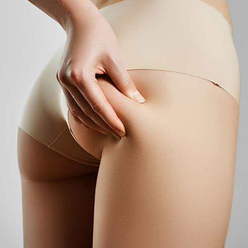cyndi sandlin add how to take thigh pics photo