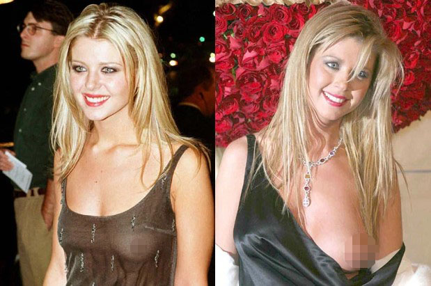 aaron chenery recommends tara reid boob pic pic