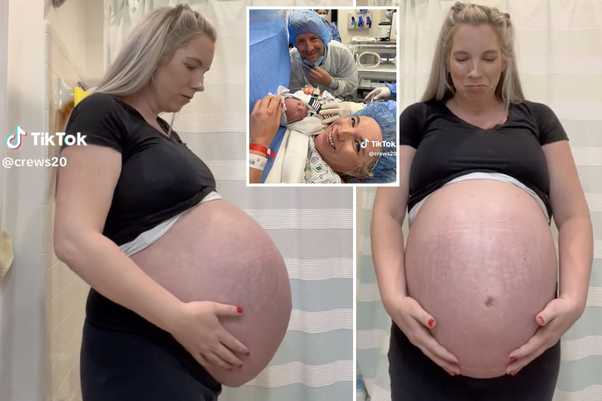 cornell lancaster recommends pregnant bellies with triplets pic
