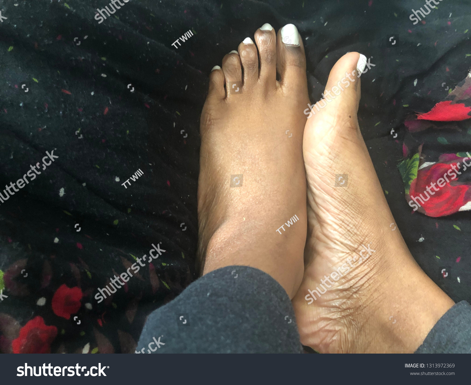 as pair recommends black women foot fetish pic