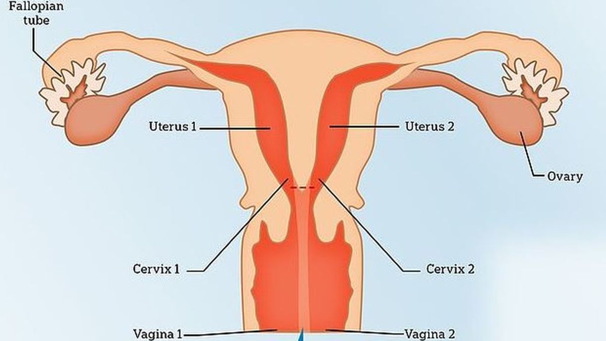 mujer con dos vaginas