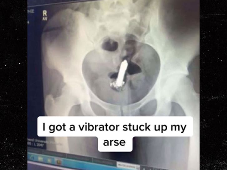 carla nascimento recommends Vibrator Stuck In Ass