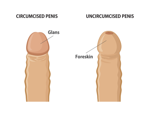 bev collum recommends Uncircumcised Penis Image