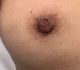 cordero bennett recommends dark nipple pics pic