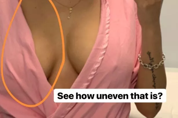 clare curley recommends mia khalifa breast reduction pic
