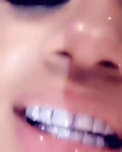 burn turn recommends Bad Teeth Smile Gif