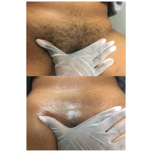 david tjarks share pics of brazilian wax photos