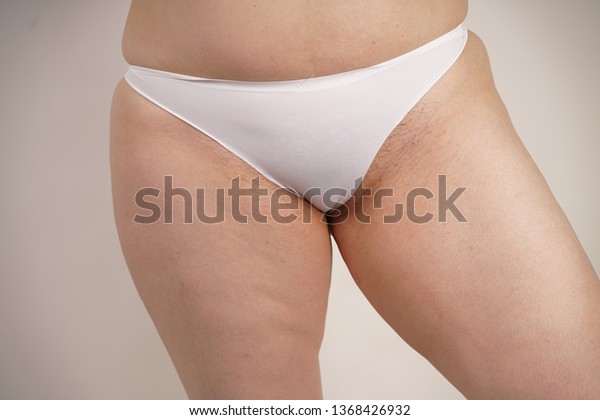 dorris washington recommends Hairy Female Crotches