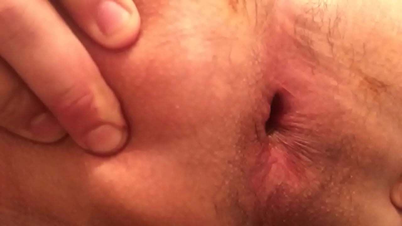 aaron venson recommends gaping ass hole pic