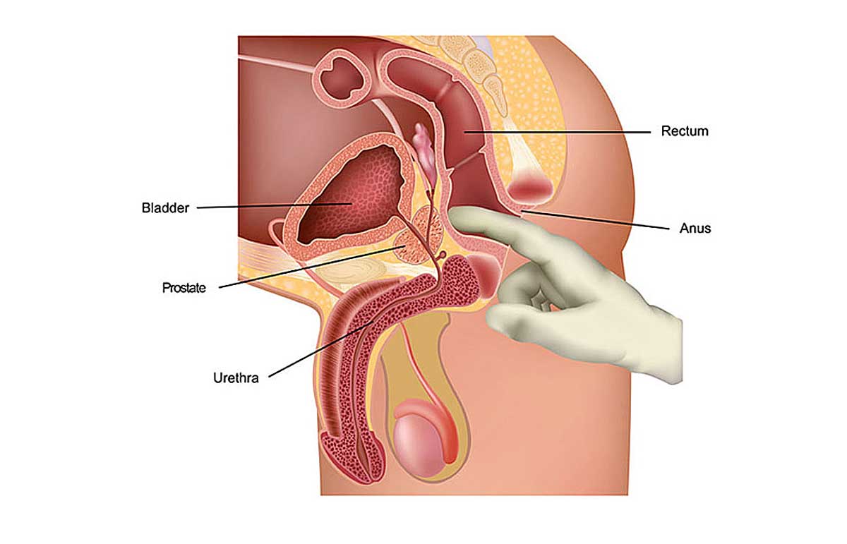 prostate milking instructional video
