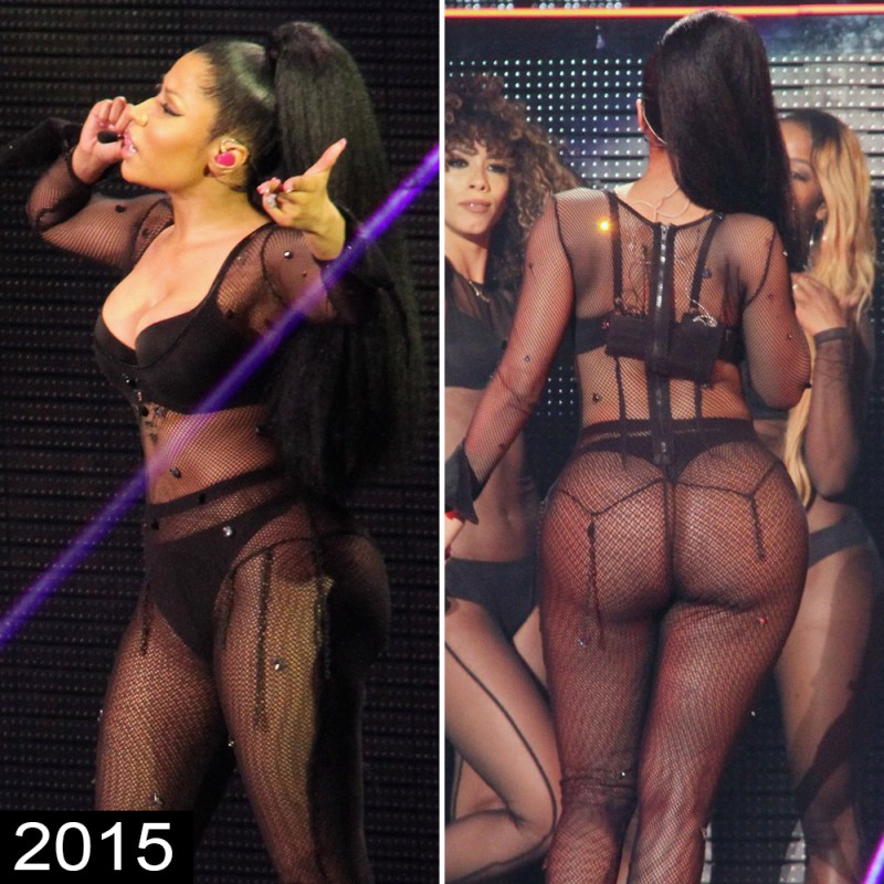 Nicki Minaj Butt Injury while masterbating