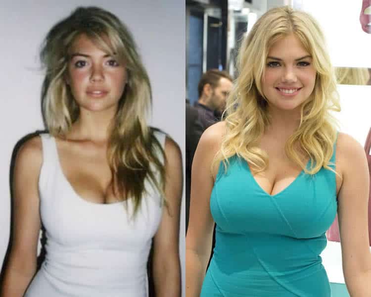 devan metz recommends kate upton boob job pic