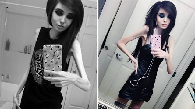 allan ansell recommends Whats Wrong With Eugenia Cooney
