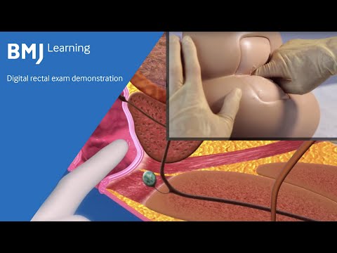 bahar javan recommends female rectal exams video pic