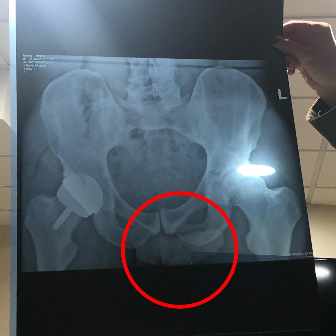 amit kite share xray with penis photos