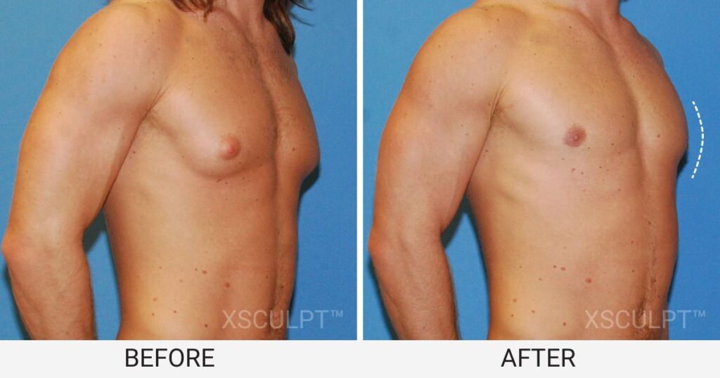 ariel serafin recommends abnormal nipples pics pic