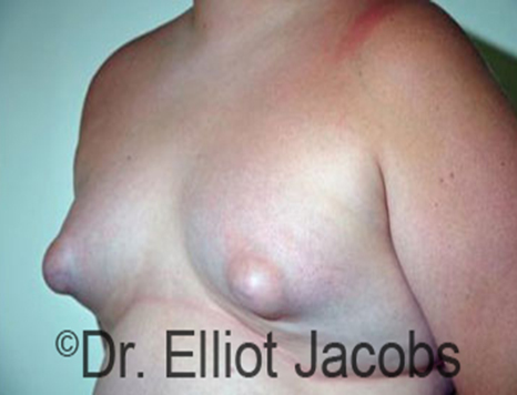 abhishek suthar share breasts with large nipples photos