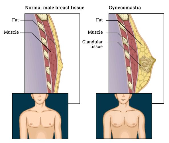 bradley mcginnis recommends budding breast photo pic