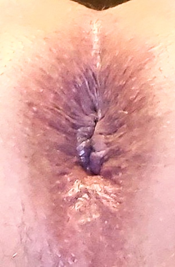 christine abcede recommends butt hole close up pic