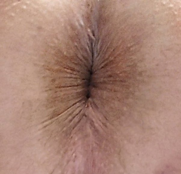 david emmitt recommends Butt Hole Close Up