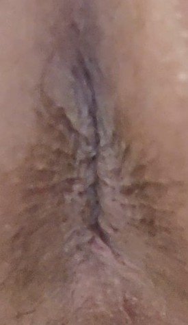 Best of Butt hole close up
