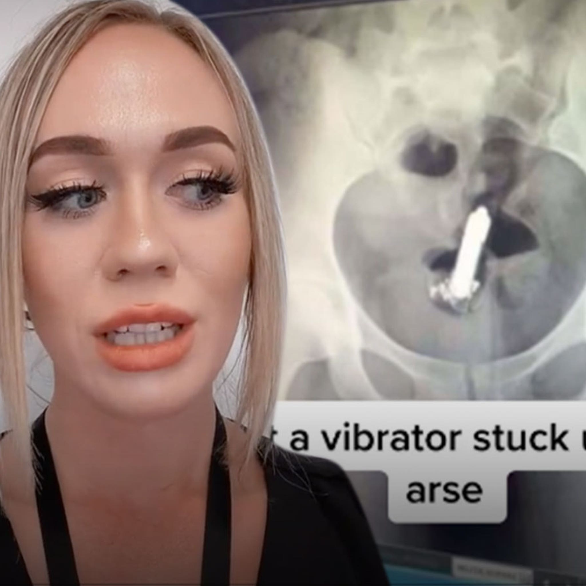 Best of Vibrator stuck in ass