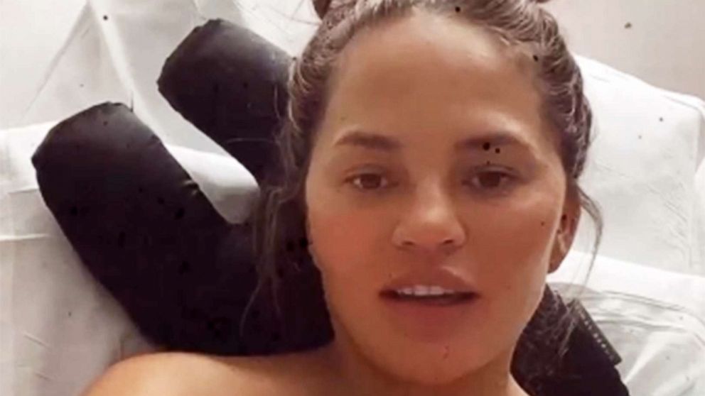 bonnie henriksen recommends chrissy teigen sex video pic