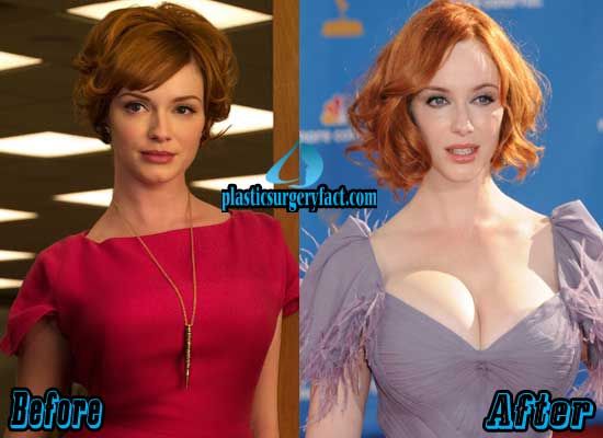 christina hendricks boobs real