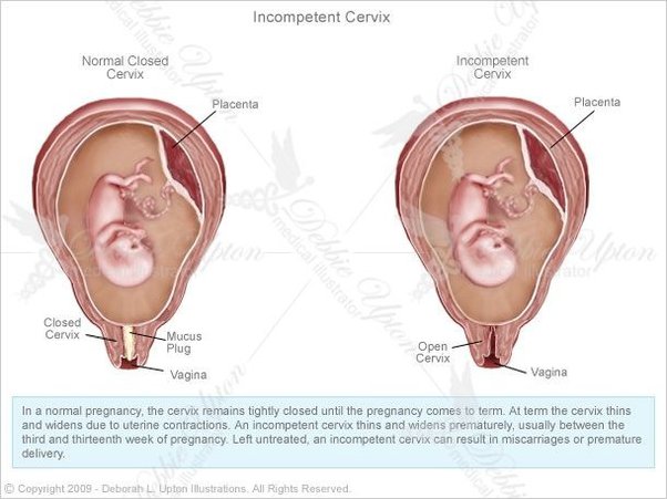 Dick In Cervix Porn center youtube