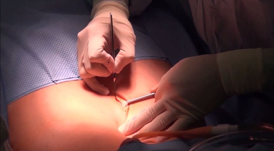 charles beckford add video of pelvic examination photo