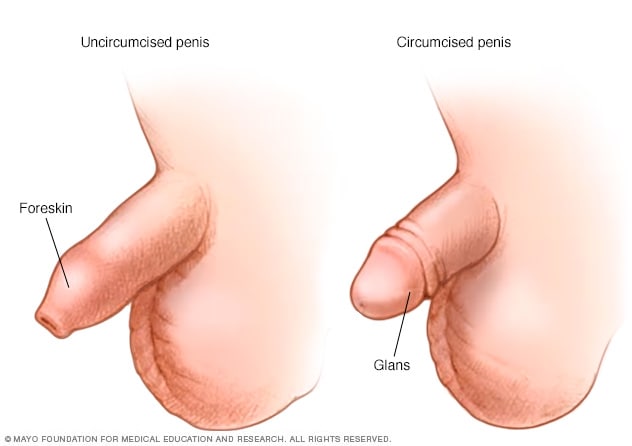 abdullah aw recommends uncircumcised penis image pic