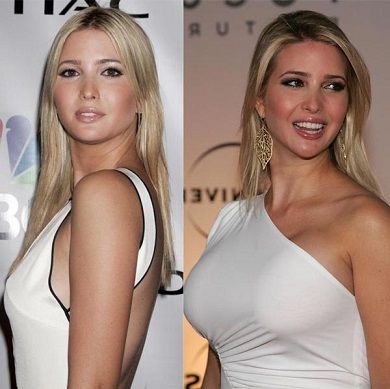 Best of Ivanka trump fake boobs