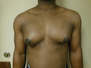 adenuga opeyemi add large breasts puffy nipples photo