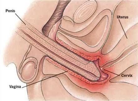 angela robertson recommends penis inside vagina images pic