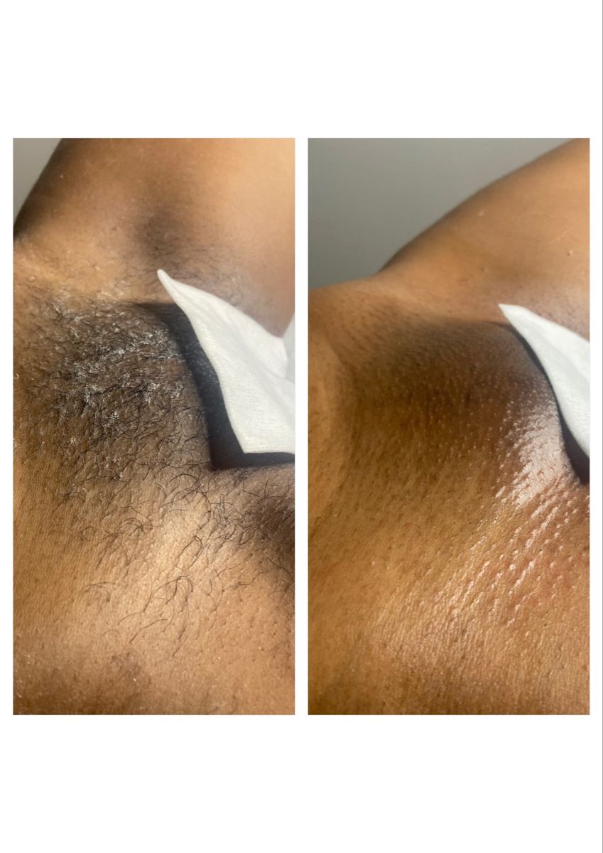 pics of brazilian wax