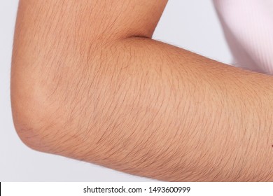 aaron belknap recommends pictures of women with hairy arms pic