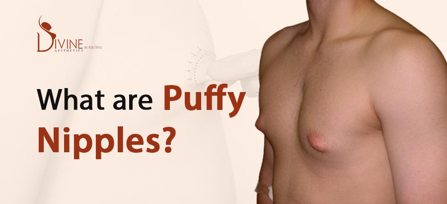 pictures of women with puffy nipples