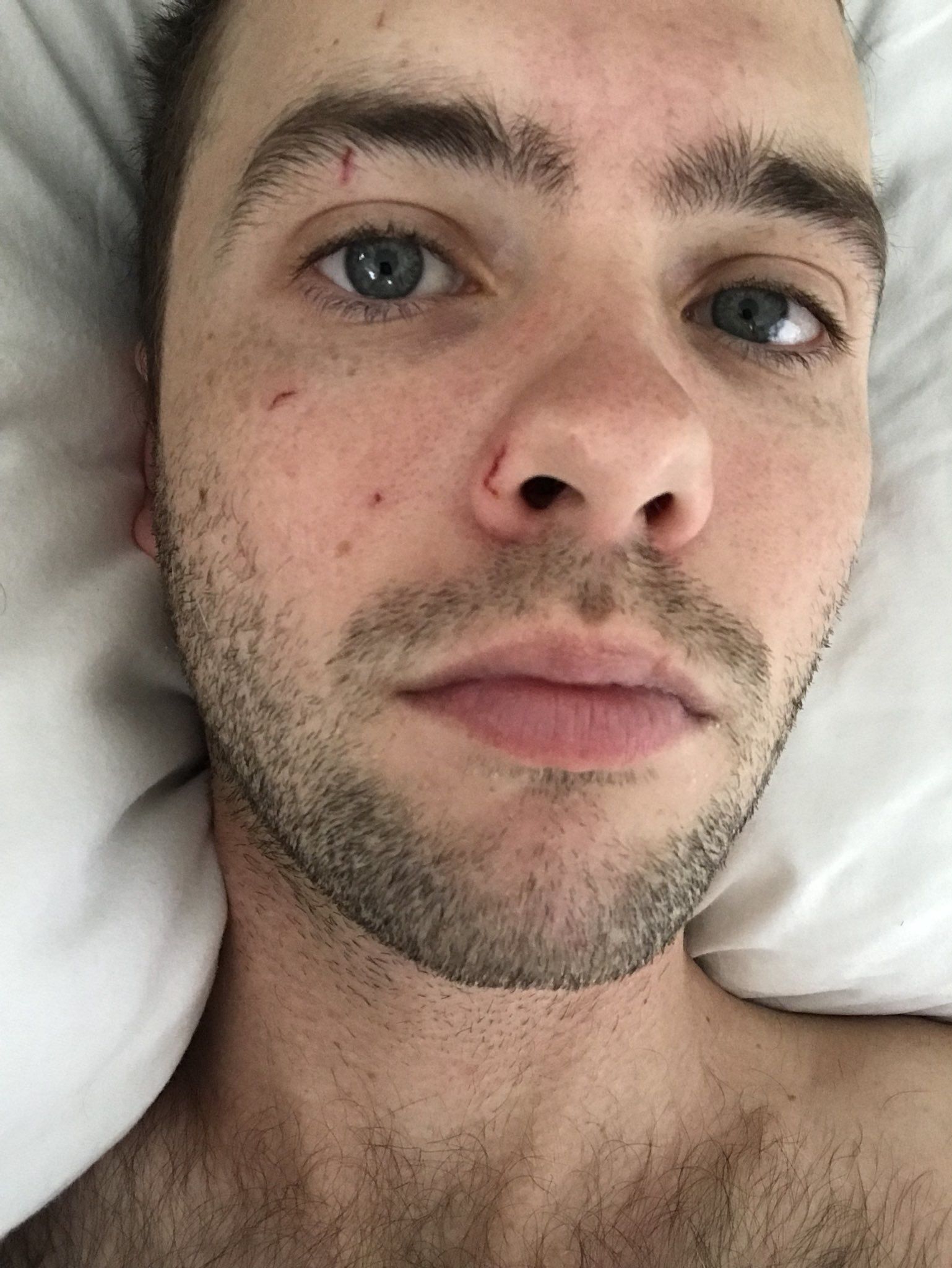denise gravel recommends ryland adams leaked pic