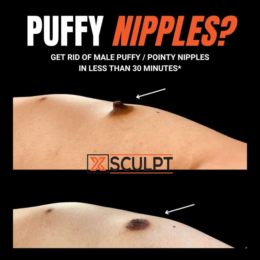 bob boyle recommends teenie with puffy nipples pic