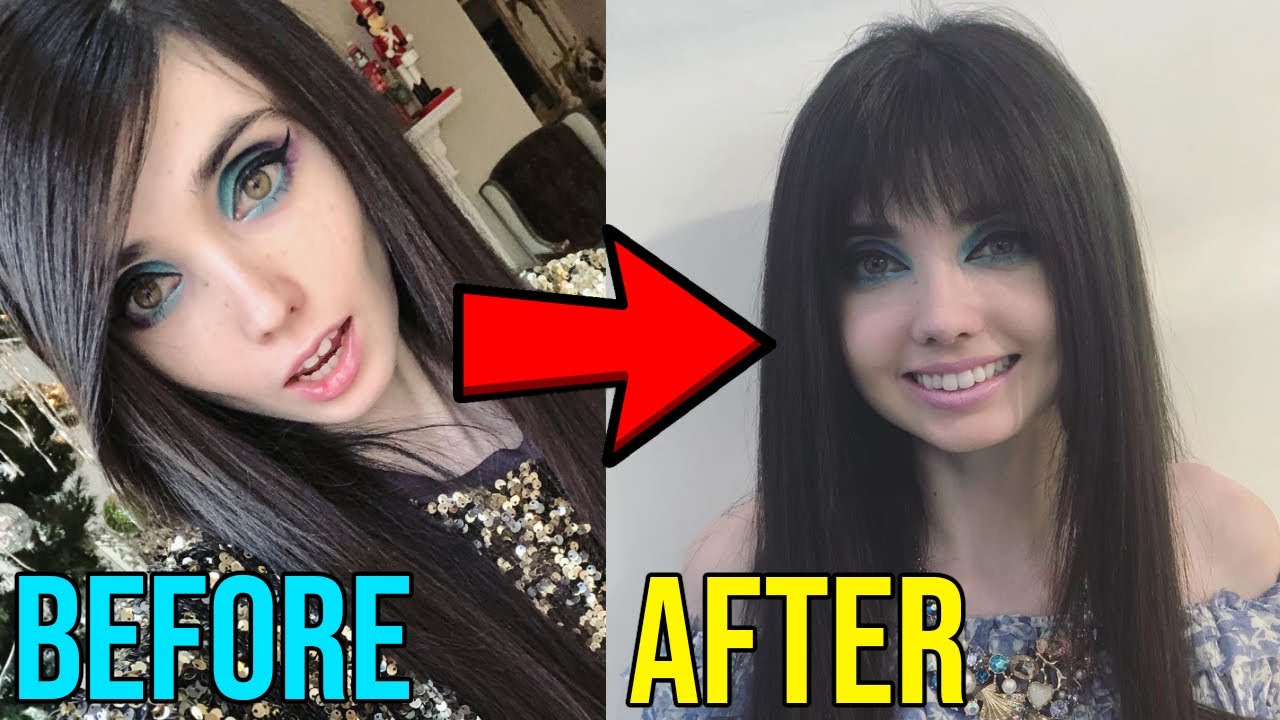 whats wrong with eugenia cooney